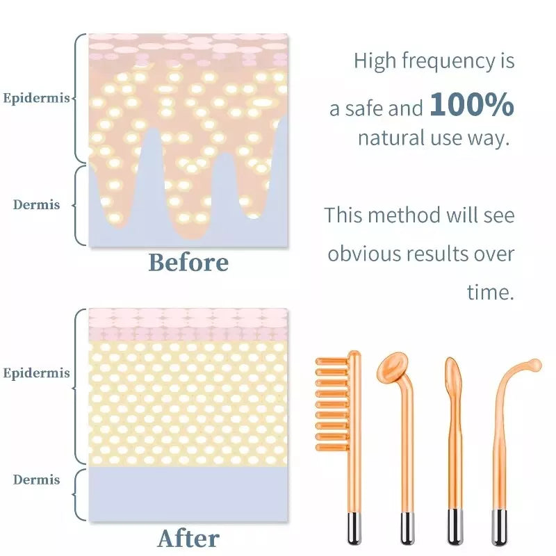 High Frequency Facial Wand