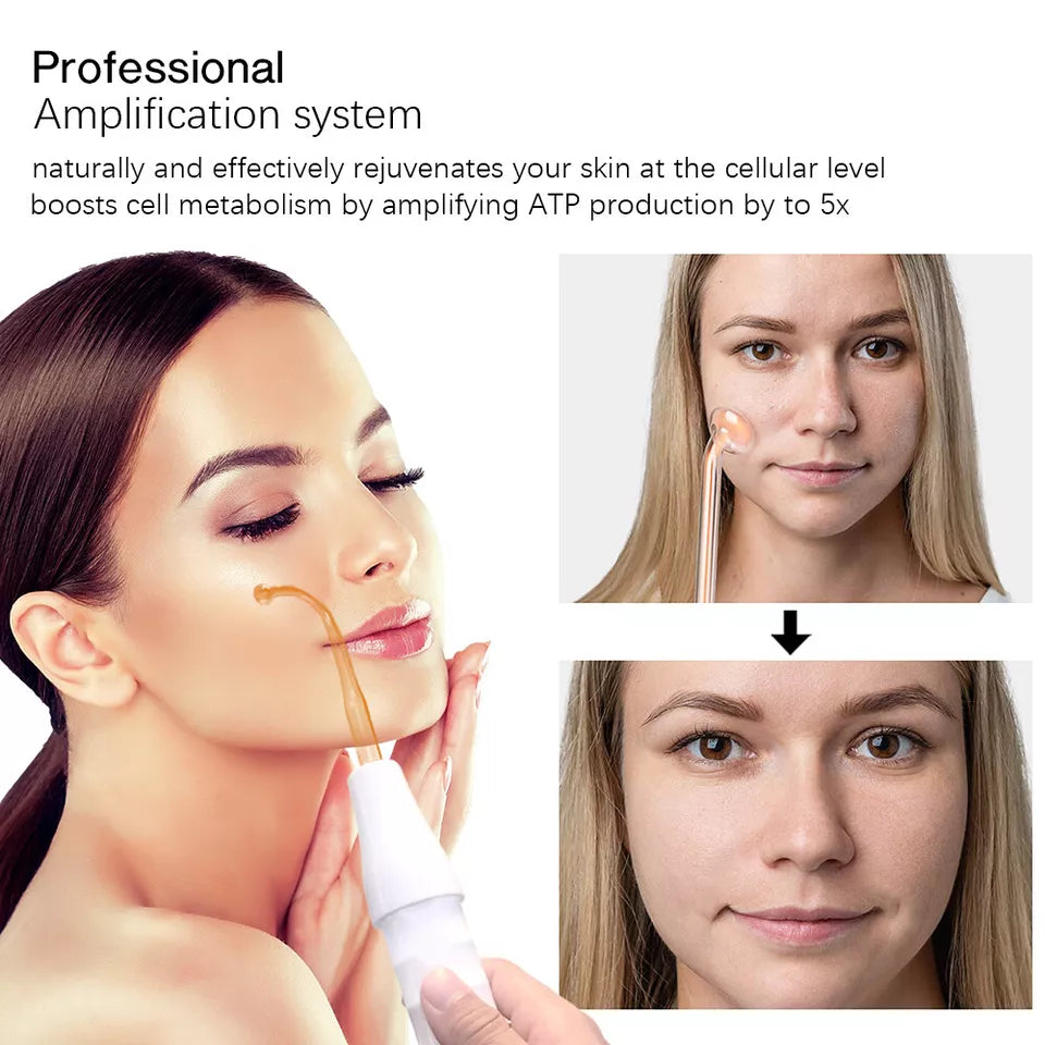 High Frequency Facial Wand
